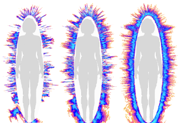 Figuur: aura