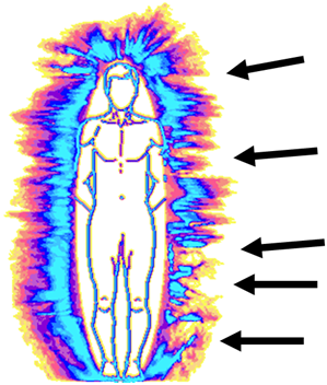Figuur: aura
