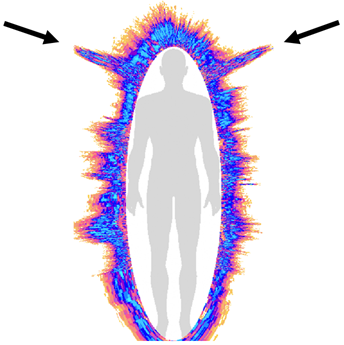 Figuur: aura