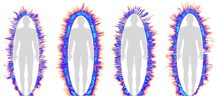 Figuur: aura